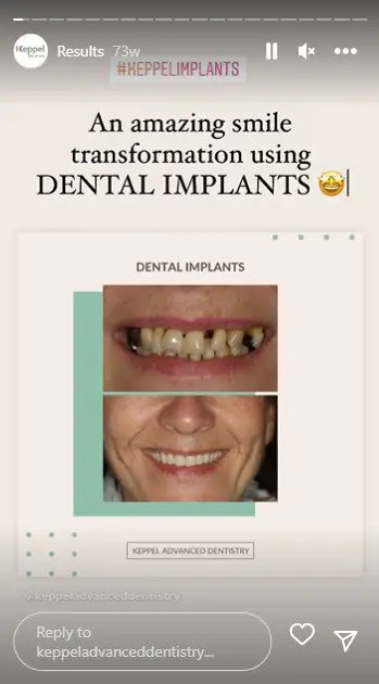 dental story - before and after