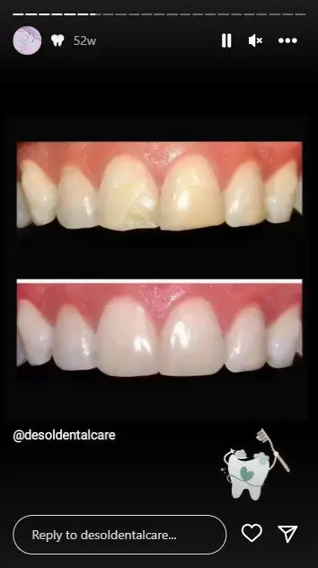 story ideas for dental service - before and after