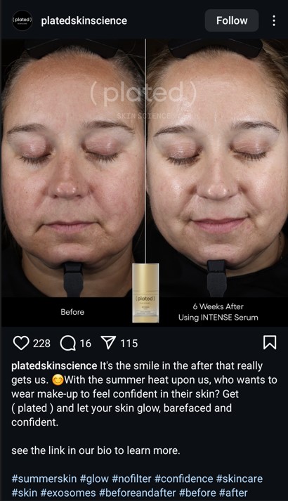 Before after post by a skincare brand